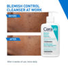 CeraVe Blemish Control Cleanser, 236ml - Image 3